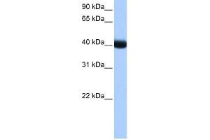 CK1 gamma 3 antibody used at 1 ug/ml to detect target protein.