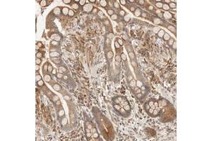 Immunohistochemical staining of human colon with TACC1 polyclonal antibody  shows moderate cytoplasmic positivity in glandular cells at 1:200-1:500 dilution. (TACC1 Antikörper)