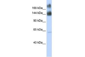 WB Suggested Anti-KTN1 Antibody Titration:  0. (KTN1 Antikörper  (Middle Region))