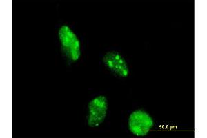 Immunofluorescence of monoclonal antibody to DOT1L on HeLa cell. (DOT1L Antikörper  (AA 3-108))