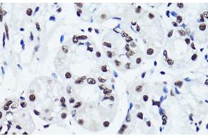 Immunohistochemistry of paraffin-embedded Human stomach using Symmetric DiMethyl-Histone H3-R2 Polyclonal Antibody at dilution of 1:100 (40x lens).