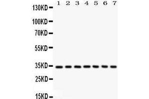 Western Blotting (WB) image for anti-Cyclin-Dependent Kinase 2 (CDK2) (AA 81-298) antibody (ABIN3043472) (CDK2 Antikörper  (AA 81-298))