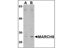 Western blot analysis of MARCH8 in HeLa cell lysate with this product at (A) 0. (MARCH8 Antikörper  (C-Term))