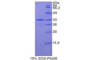 SDS-PAGE (SDS) image for Coagulation Factor X (F10) (AA 235-488) protein (His tag,GST tag) (ABIN1877824) (Coagulation Factor X Protein (F10) (AA 235-488) (His tag,GST tag))
