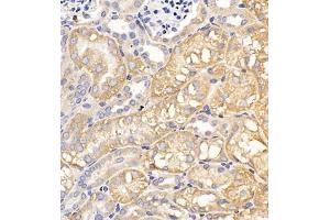 Immunohistochemistry of paraffin embedded mouse kidney using Clcn5 (ABIN7073471) at dilution of 1:200 (400x lens) (Chloride Channel 5 Antikörper)