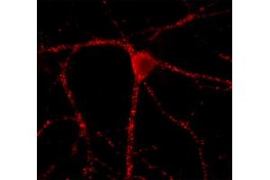 Immunolabeling of cultured hippocampus neurons (dilution 1 : 500). (GAD65 Antikörper  (AA 3-96))
