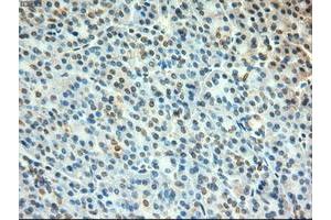 Image no. 1 for anti-Myc Proto-Oncogene protein (MYC) antibody (ABIN1497011) (c-MYC Antikörper)