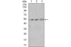 Western blot analysis using SPIB mouse mAb against A549 (1), PC-3 (2), and NIH3T3 (3) cell lysate. (SPIB Antikörper  (AA 200-252))