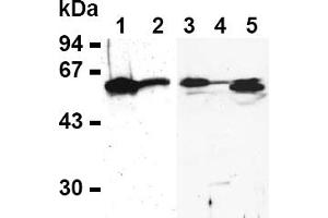 Western Blotting (WB) image for anti-E2F Transcription Factor 4, P107/p130-Binding (E2F4) antibody (ABIN487490) (E2F4 Antikörper)