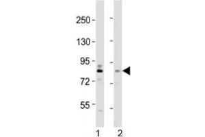Western blot testing of DYRK1A antibody at 1:2000 dilution. (DYRK1A Antikörper  (AA 107-136))