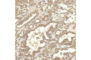 IHC analysis of TXNDC5 using anti-TXNDC5 antibody (ABIN7599699).