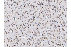 IHC analysis of RPL11 using anti-RPL11 antibody (ABIN7602315).