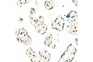 Immunohistochemistry (IHC) image for anti-Protein Quaking (QKI) antibody (ABIN7269699)