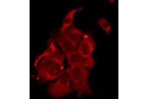 ABIN6276221 staining MCF7 by IF/ICC. (TAS2R14 Antikörper  (Internal Region))