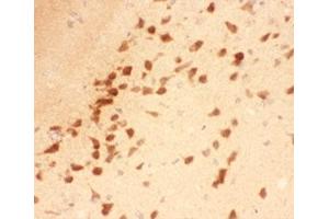 Immunohistochemistry (IHC) image for anti-Brain-Derived Neurotrophic Factor (BDNF) (AA 129-247) antibody (ABIN3030195)