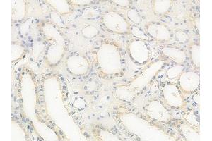 ABIN6258203 and ABIN6273889 at 1/100 staining human normal kidney tissue by IHC-P. (GPR68 Antikörper  (Internal Region))