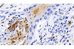 Immunohistochemistry (IHC) image for anti-Caspase 1 (CASP1) (AA 120-297) antibody (ABIN7433831)