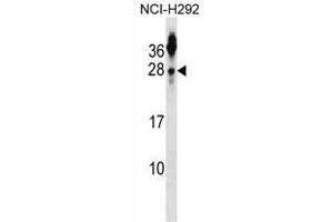 TSPAN2 Antibody (N-term) western blot analysis in NCI-H292 cell line lysates (35 µg/lane).