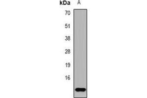 Western blot analysis of TF2A2 expression in NCIH460 (A) whole cell lysates. (GTF2A2 Antikörper)