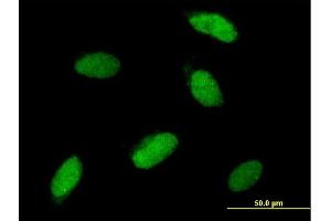 Immunofluorescence of purified MaxPab antibody to SNAI1 on HeLa cell. (SNAIL Antikörper  (AA 1-264))