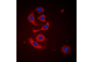 Immunofluorescent analysis of Calreticulin staining in HeLa cells. (Calreticulin Antikörper  (N-Term))