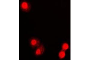 Immunofluorescent analysis of PML staining in COLO320 cells. (PML Antikörper  (N-Term))