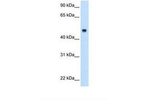Image no. 2 for anti-Complement Component 8, beta Polypeptide (C8B) (AA 321-370) antibody (ABIN6738114) (C8B Antikörper  (AA 321-370))