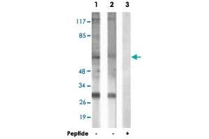 Western blot analysis of extracts from HepG2 cells (Lane 1) and COLO 205 cells (Lane 2 and 3), using MITF polyclonal antibody . (MITF Antikörper  (Ser73, Ser180))