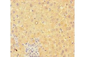 Immunohistochemistry of paraffin-embedded human liver tissue using ABIN7144096 at dilution of 1:100 (C19ORF80 Antikörper  (AA 22-198))