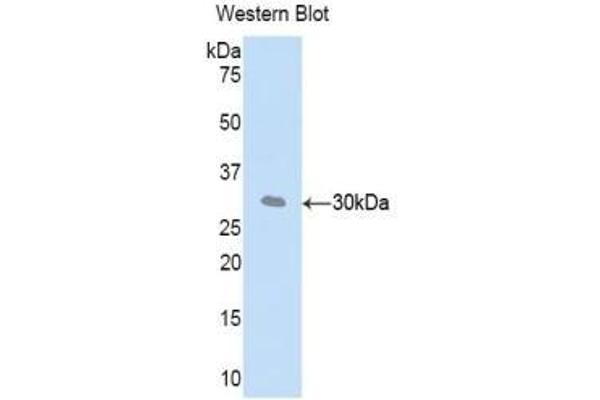 Adipsin Antikörper  (AA 1-259)