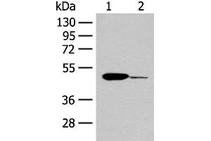 Western blot analysis of Mouse heart tissue and K562 cell lysates using ACOD1 Polyclonal Antibody at dilution of 1:400 (IRG1 Antikörper)
