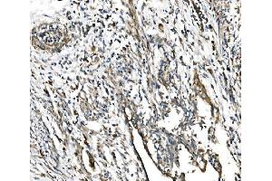 IHC analysis of GFPT1 using anti-GFPT1 antibody (ABIN7602887). (GFPT1 Antikörper  (C-Term))