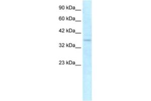 Western Blotting (WB) image for anti-NLR Family, CARD Domain Containing 4 (NLRC4) antibody (ABIN2463643) (NLRC4 Antikörper)