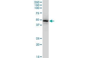 GATA1 monoclonal antibody (M06), clone 3G6. (GATA1 Antikörper  (AA 123-199))