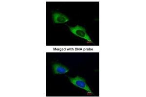 ICC/IF Image Immunofluorescence analysis of paraformaldehyde-fixed HeLa, using MTMR9, antibody at 1:200 dilution. (MTMR9 Antikörper  (C-Term))