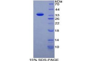 TAF1 Protein