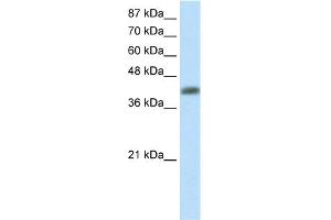 WB Suggested Anti-APTX Antibody Titration:  2. (Aprataxin Antikörper  (C-Term))
