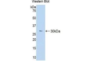 Detection of Recombinant MCSFR, Mouse using Polyclonal Antibody to Colony Stimulating Factor Receptor, Macrophage (MCSFR) (CSF1R Antikörper  (AA 639-868))