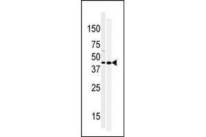 Western blot analysis of anti-MOS-R8 Pab (ABIN392644 and ABIN2842147) in 293 and Hela cell line lysate (35 μg/lane). (MOS Antikörper  (N-Term))