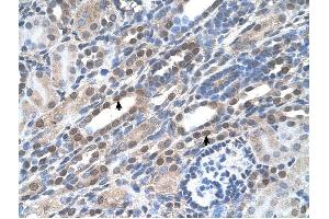 NOLC1 antibody was used for immunohistochemistry at a concentration of 4-8 ug/ml to stain Epithelial cells of renal tubule (arrows) in Human Kidney.