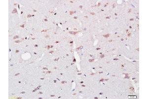 Paraformaldehyde-fixed, paraffin embedded rat brain tissue, Antigen retrieval by boiling in sodium citrate buffer(pH6) for 15min, Block endogenous peroxidase by 3% hydrogen peroxide for 30 minutes, Blocking buffer (normal goat serum) at 37°C for 20min, Antibody incubation with Rabbit Anti-UBE2Q1 Polyclonal Antibody, Unconjugated  at 1:500 overnight at 4°C, followed by a conjugated secondary and DAB staining (UBE2Q1 Antikörper  (AA 321-422))