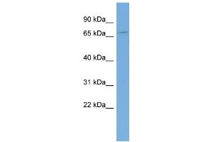 anti-KH Domain Containing 4, Pre-mRNA Splicing Factor (KHDC4) (Middle Region) antibody