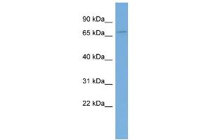WB Suggested Anti-KIAA0907 Antibody Titration: 0.