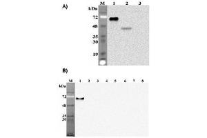 Western blot analysis of human Pref-1using anti-DLK1 (human), mAb  (PF299-1)  at 1: 2,000 dilution.