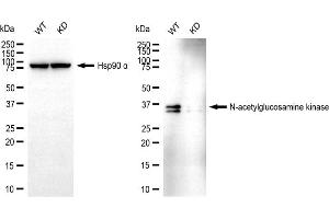 Western blotting analysis using N-acetylglucosamine kinase antibody (ABIN7799529). (NAGK Antikörper)