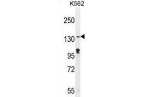 Western Blotting (WB) image for anti-OVOS1 antibody (ABIN2996287) (OVOS1 Antikörper)