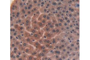 Used in DAB staining on fromalin fixed paraffin- embedded liver tissue (ITIH4 Antikörper  (AA 721-942))