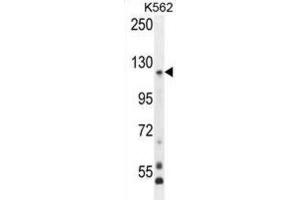 Western Blotting (WB) image for anti-Protocadherin gamma Subfamily A, 8 (PCDHGA8) antibody (ABIN2996490) (PCDHGA8 Antikörper)