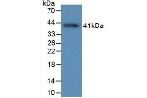 Western Blotting (WB) image for anti-Tryptase alpha/beta 1 (TPSAB1) (AA 161-262) antibody (ABIN7428305)