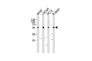Western blot analysis of lysates from A549, LNCaP, PC-3 cell line and rat brain tissue lysate (from left to right), using ADRA1D Antibody (N-term) (ABIN1945085 and ABIN2838547). (ADRA1D Antikörper  (N-Term))